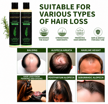 🔥LAST DAY 50% OFF - 🌿JOINTIOO® Organic Rosemary Hair Growth Shampoo